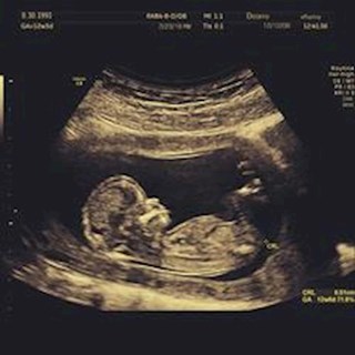 Offspring by Deorro Download